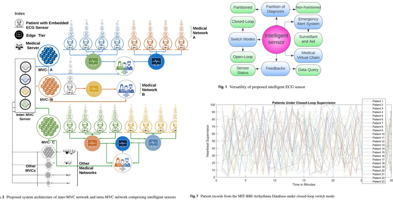 Intelligent Wearable ECG Sensor